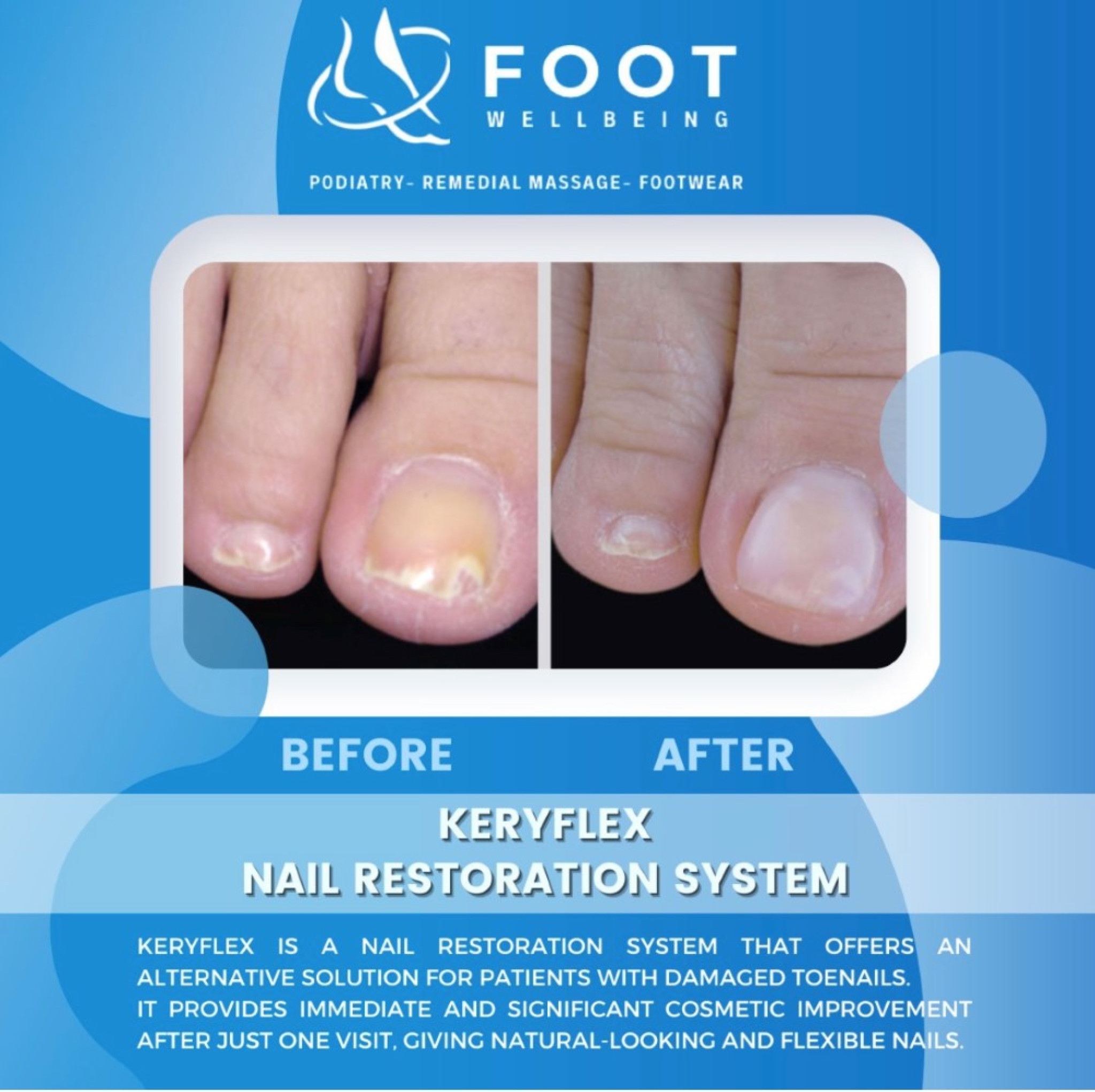 nail-restore-treatment-(custom).jpg